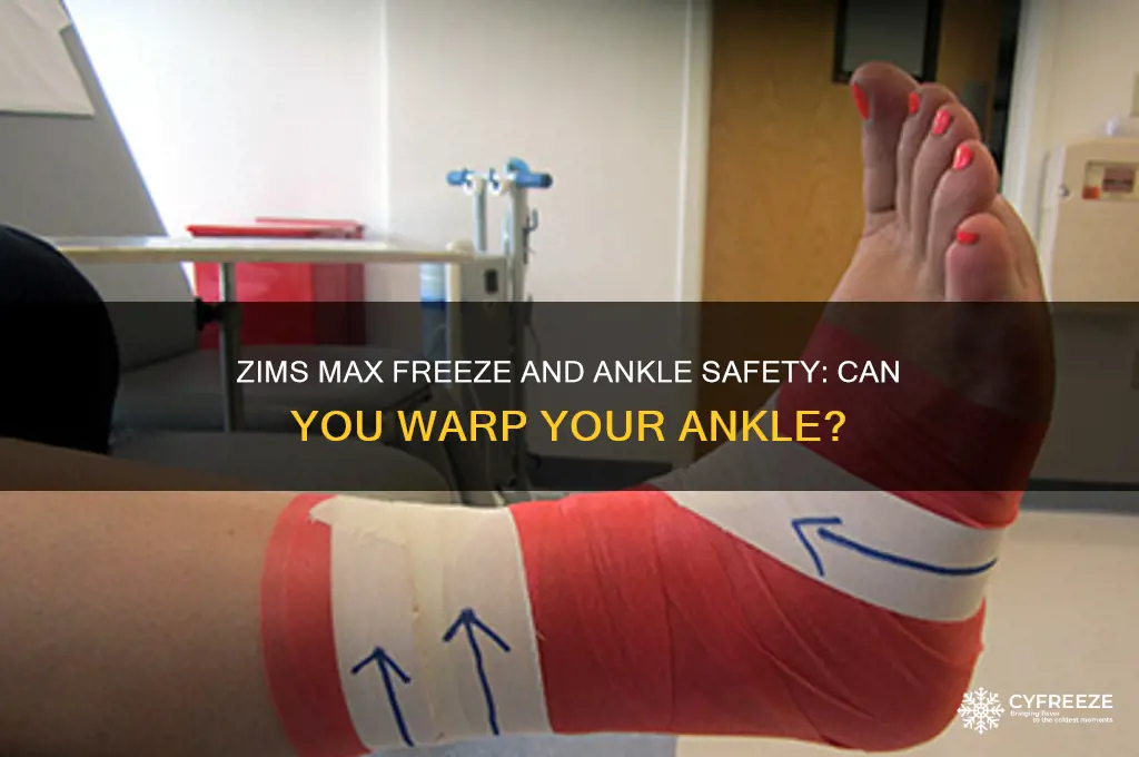 can you warp your ankle after using zims max freeze