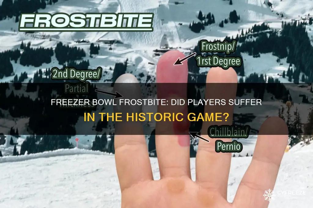 did players get frostbite during freezer bowl