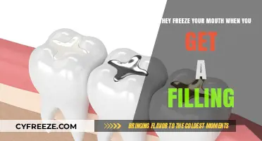 Do Dental Fillings Freeze Your Mouth? Debunking Common Myths