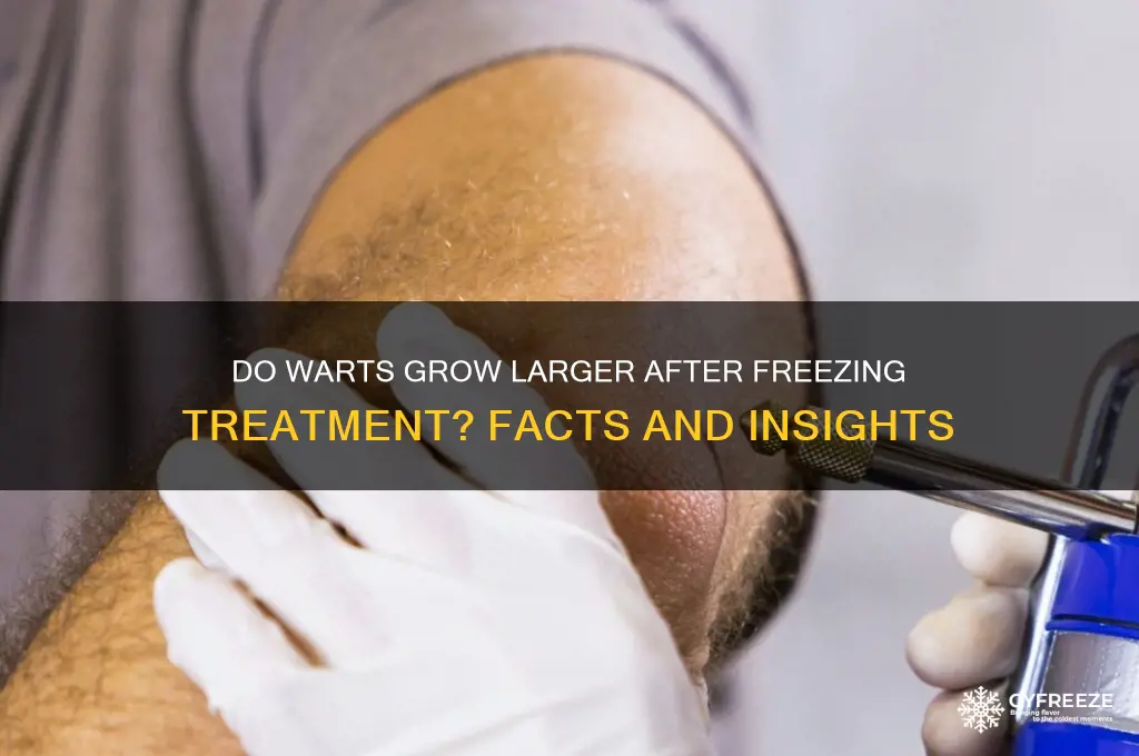 do warts get bigger after freezing