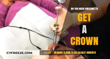 Does Crown Placement Require Freezing? Debunking Dental Myths and Facts