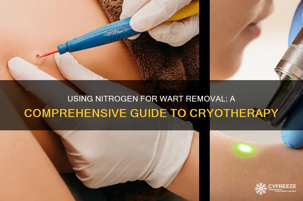 do you use nitrogen to freeze warts