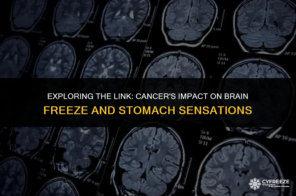does cancer make brain freeze go down to stomach