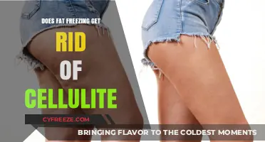 Can Fat Freezing Smooth Cellulite? Uncovering the Truth Behind the Treatment