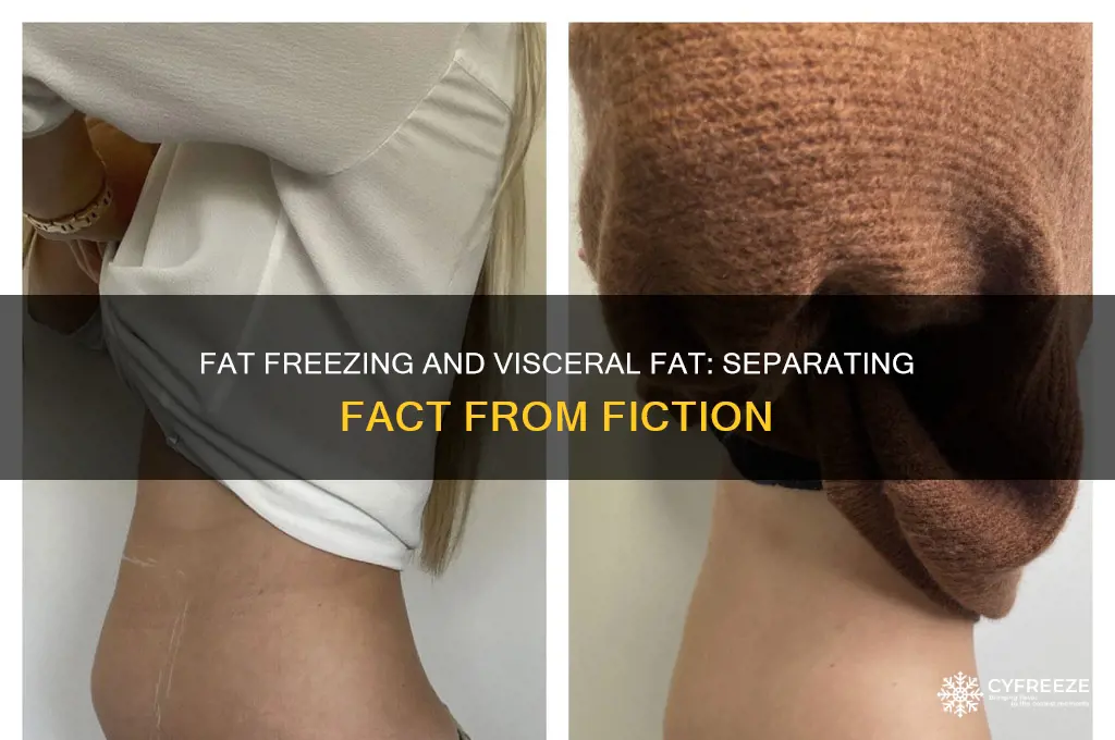 does fat freezing get rid of viseral fat