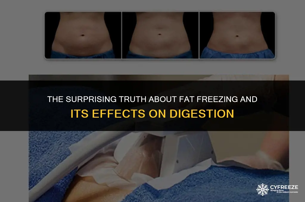 does fat freezing make you poop