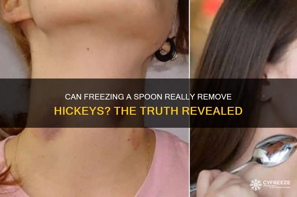 does freezing a spoon get rid of hickeys