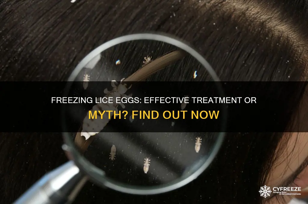 does freezing kill lice eggs