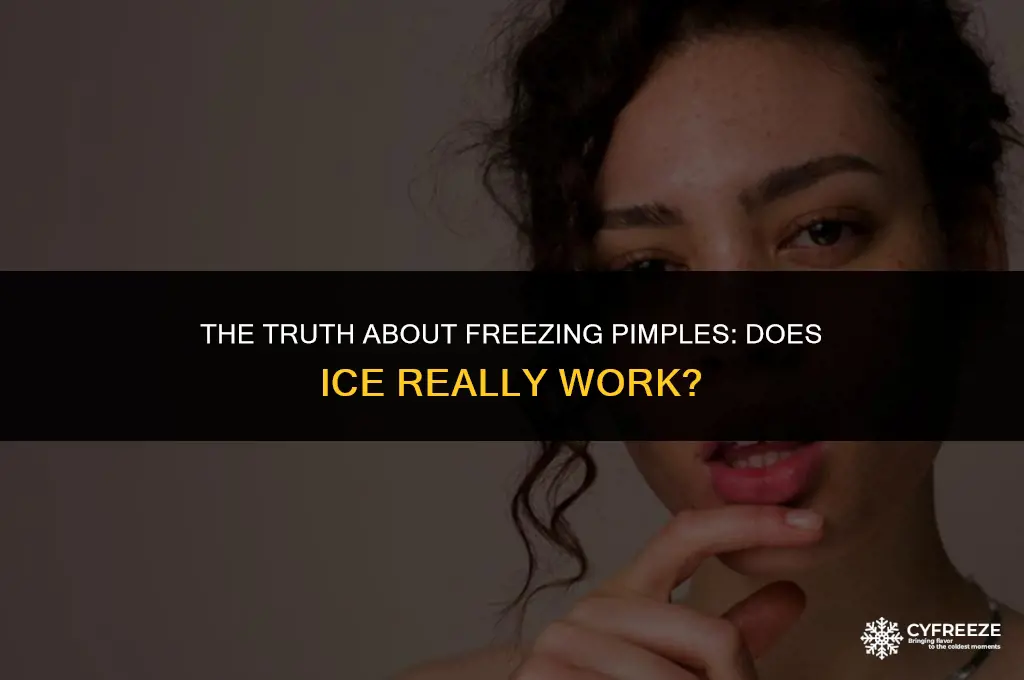 does freezing pimples with ice work