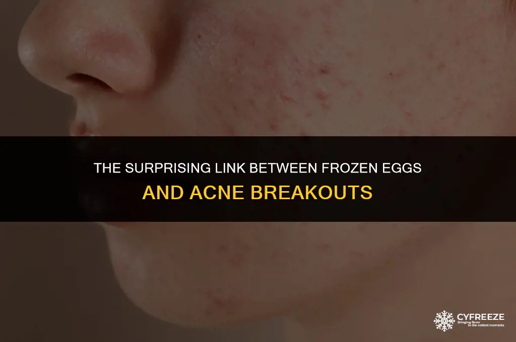 does freezing your eggs make your break out