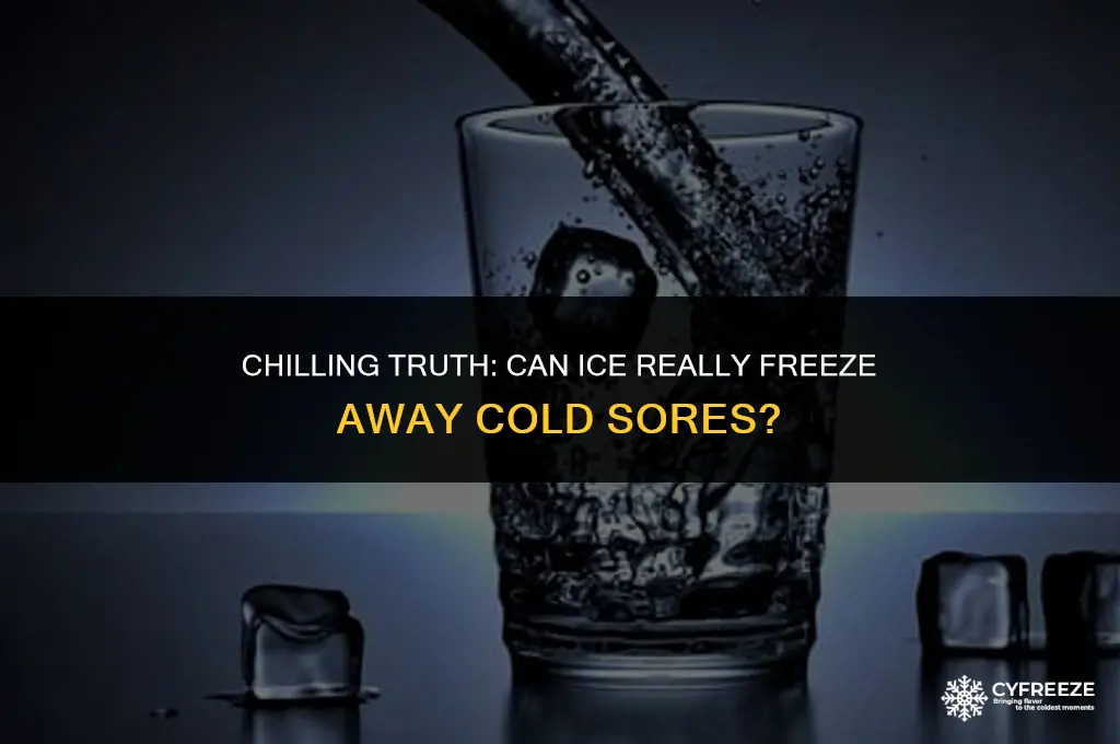 does ice freeze cold sores