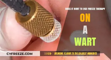 Does Freeze Therapy Hurt? Wart Removal Pain Explained