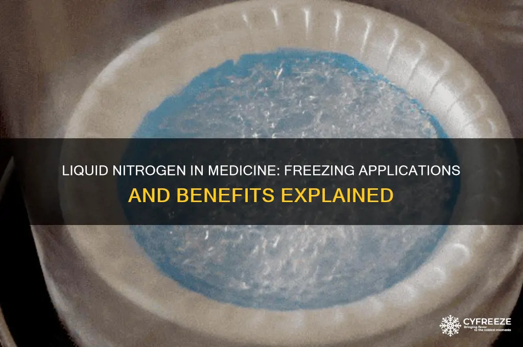 does the medical use liquid nitrogen for freezing