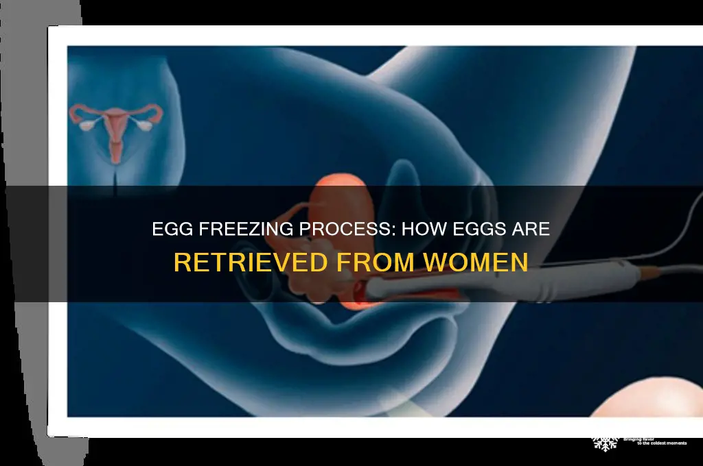 how are eggs obtained from a woman for egg freezing