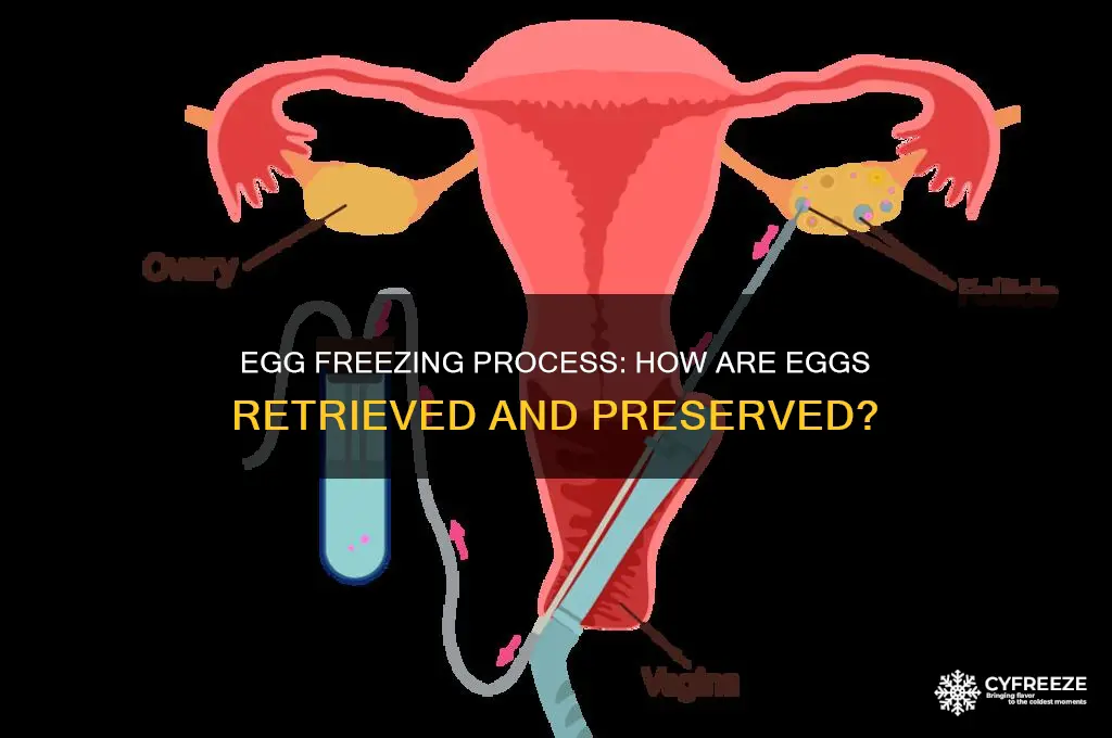 how do they get your eggs to freeze them