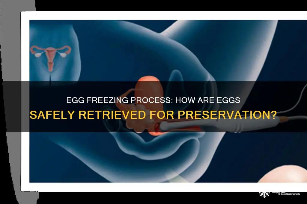 how do they remove eggs for freezing
