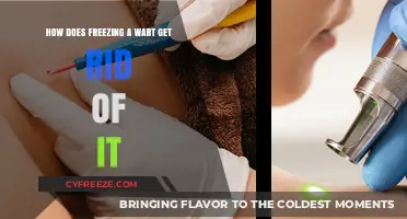 Understanding Cryotherapy: How Freezing Eliminates Warts Effectively and Safely