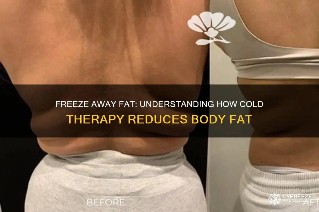 how does freezing help to get rid of body fat
