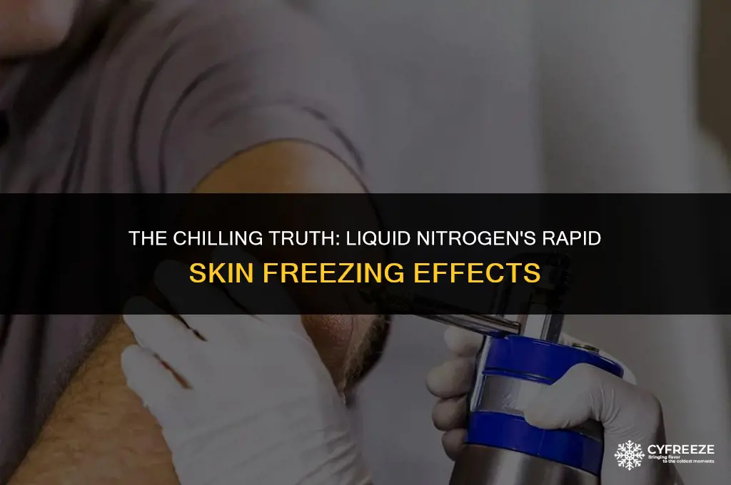 how fast will liquid nitrogen freeze your skin