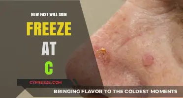 Chilling Insights: The Speed of Skin Freezing at Celsius Temperatures