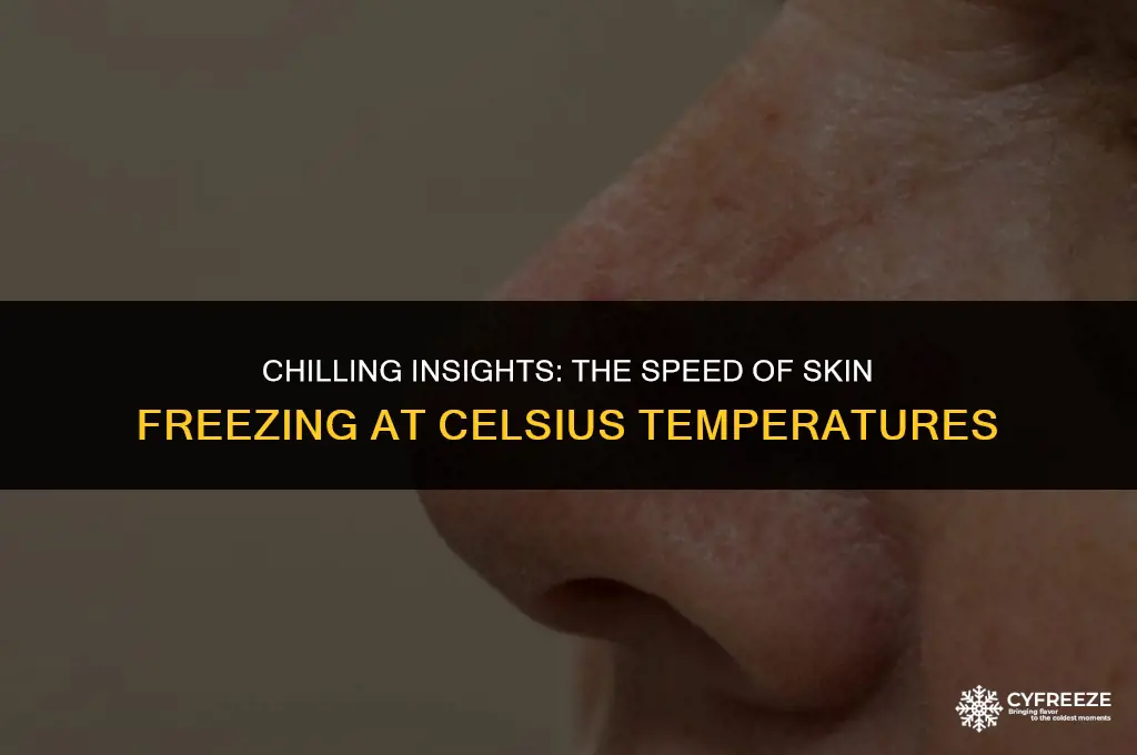 how fast will skin freeze at c