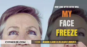 Understanding Botox: Timeline for Facial Freeze and Results