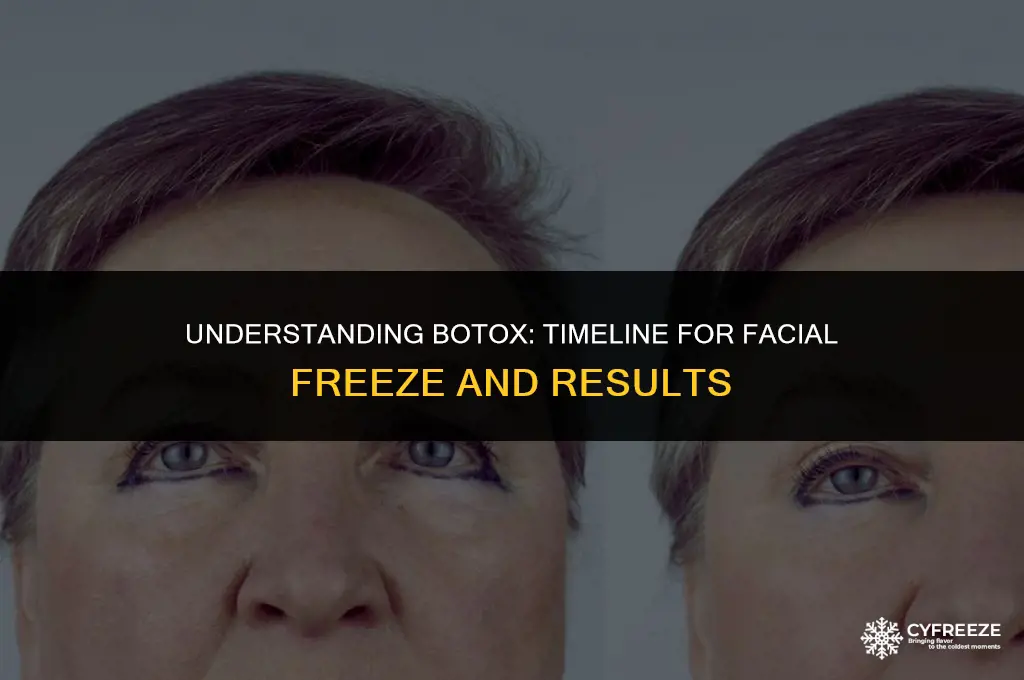 how long after botox will my face freeze