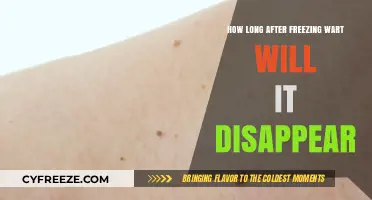 Understanding Wart Removal: The Timeline After Freezing