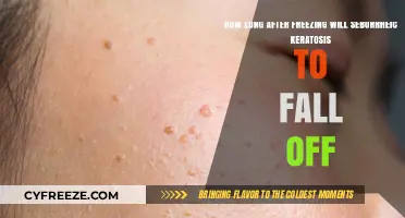 Understanding Seborrheic Keratosis: The Freezing Timeline Explained