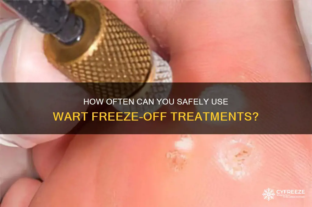 how many times can you use wart freeze off