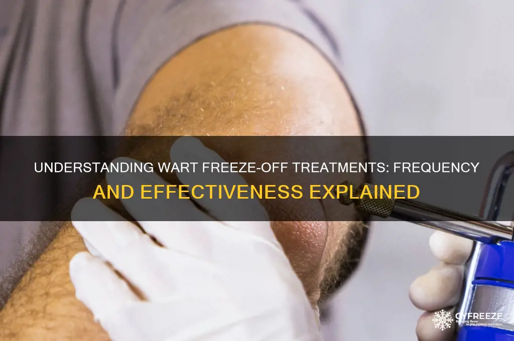 how many treatments of wart freeze off do i get