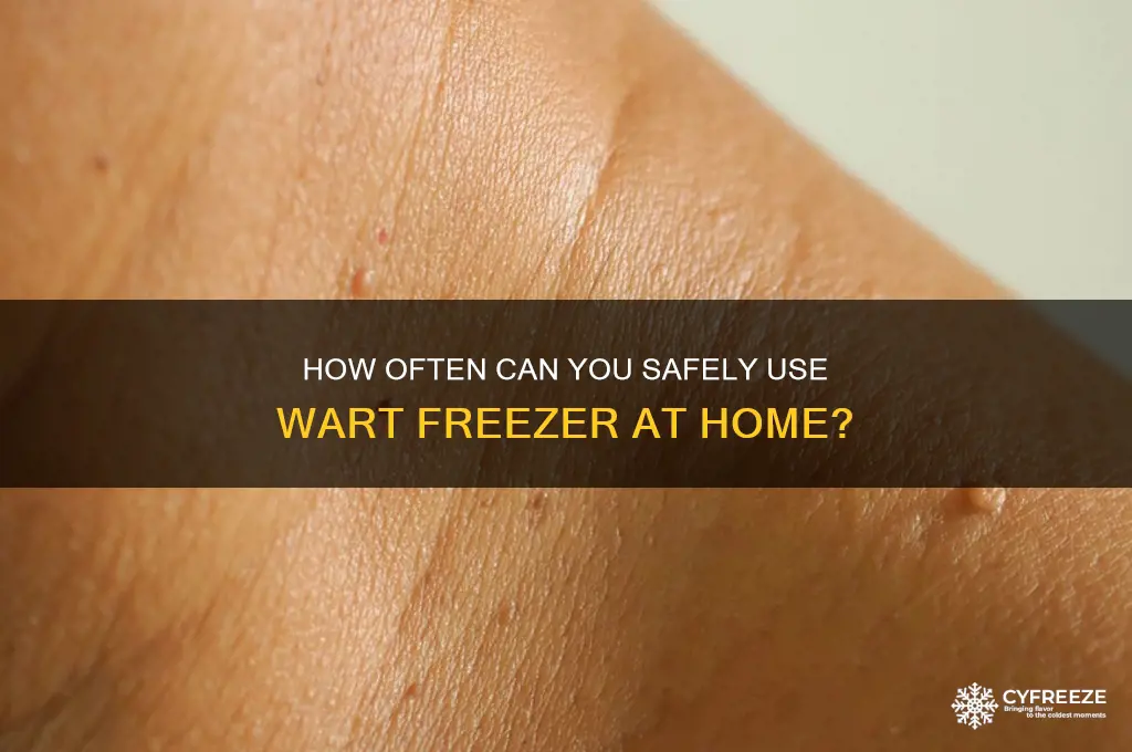 how often can you use wart freezer
