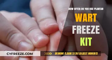 Effective Plantar Wart Treatment: How Often to Use Freeze Kits