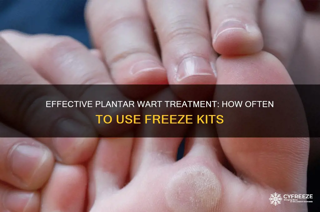 how often do you use plantar wart freeze kit
