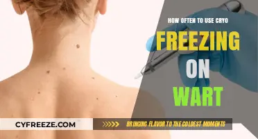Effective Cryo Freezing Frequency for Wart Removal: A Comprehensive Guide