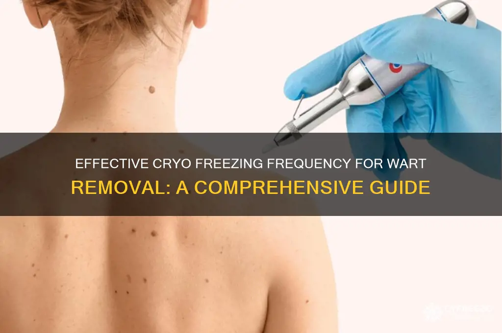 how often to use cryo freezing on wart