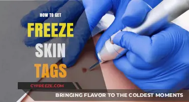 Effective Methods to Safely Freeze and Remove Skin Tags at Home