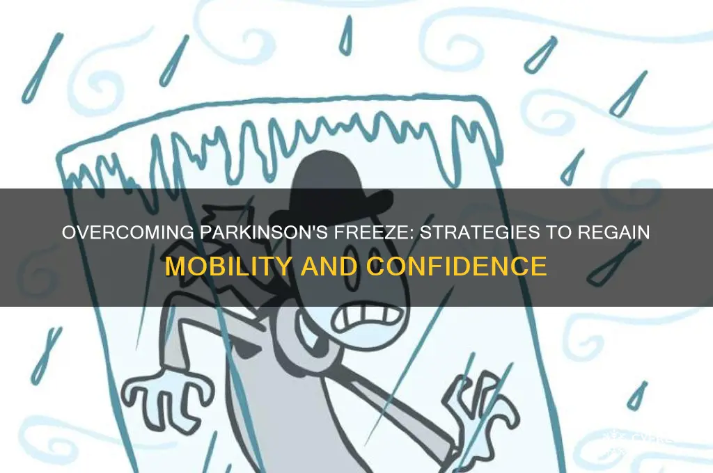 how to get out of a freeze parkinson