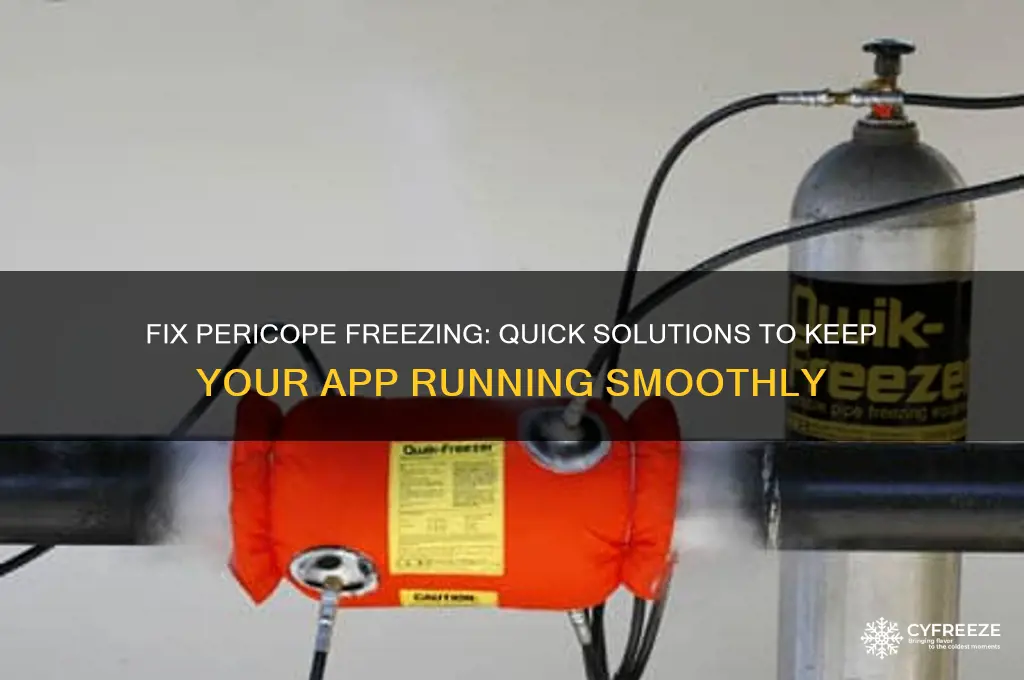 how to get pericope to stop freezing