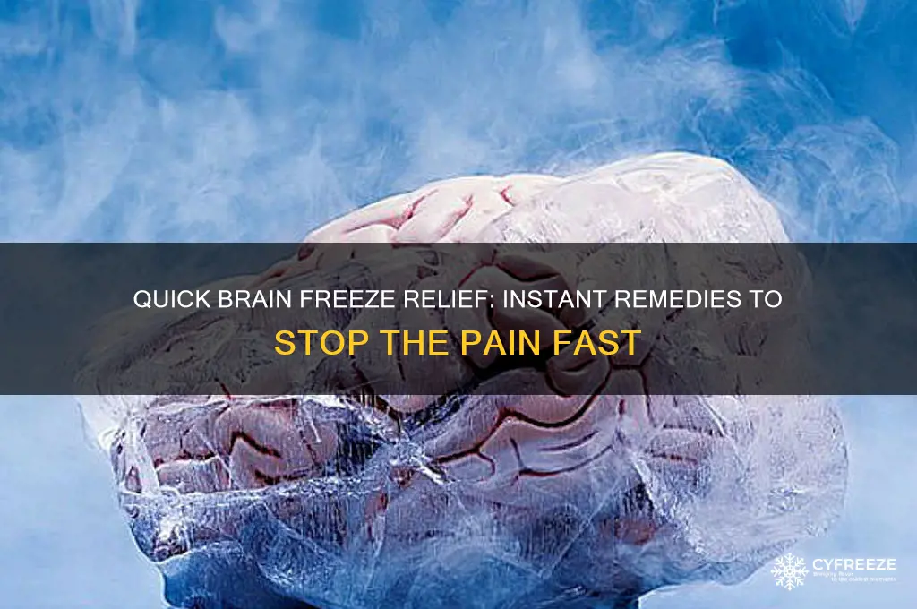 how to get rid of a brain freeze fast