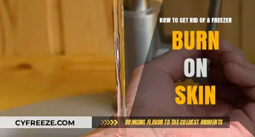 Effective Remedies to Heal Freezer Burn on Skin Quickly and Safely