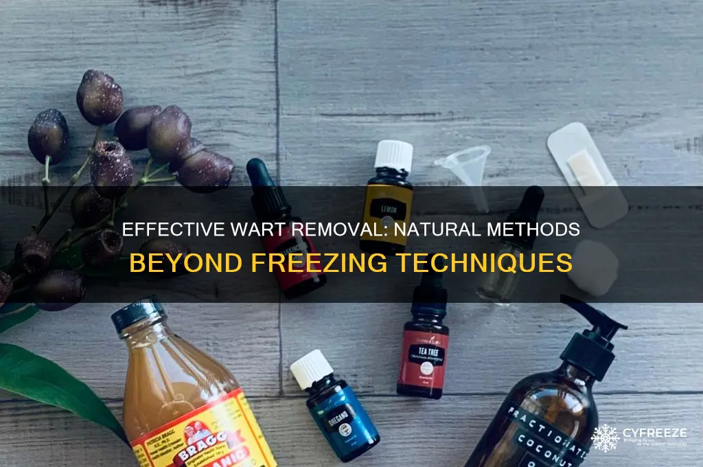 how to get rid of a wart without freezing it