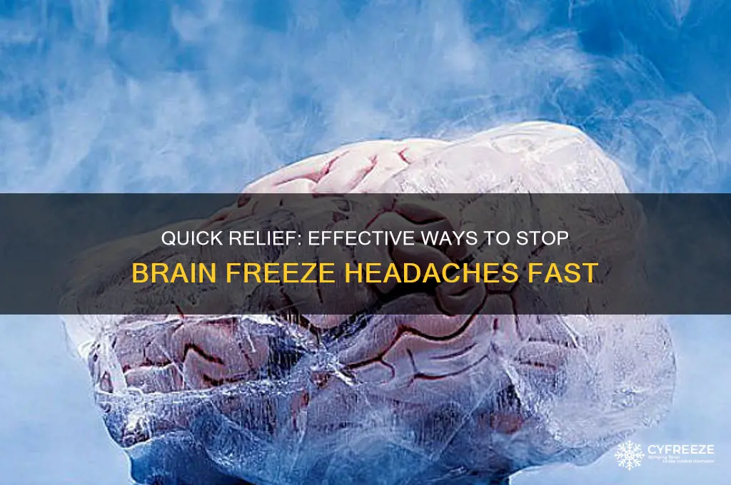 how to get rid of brain freeze headache