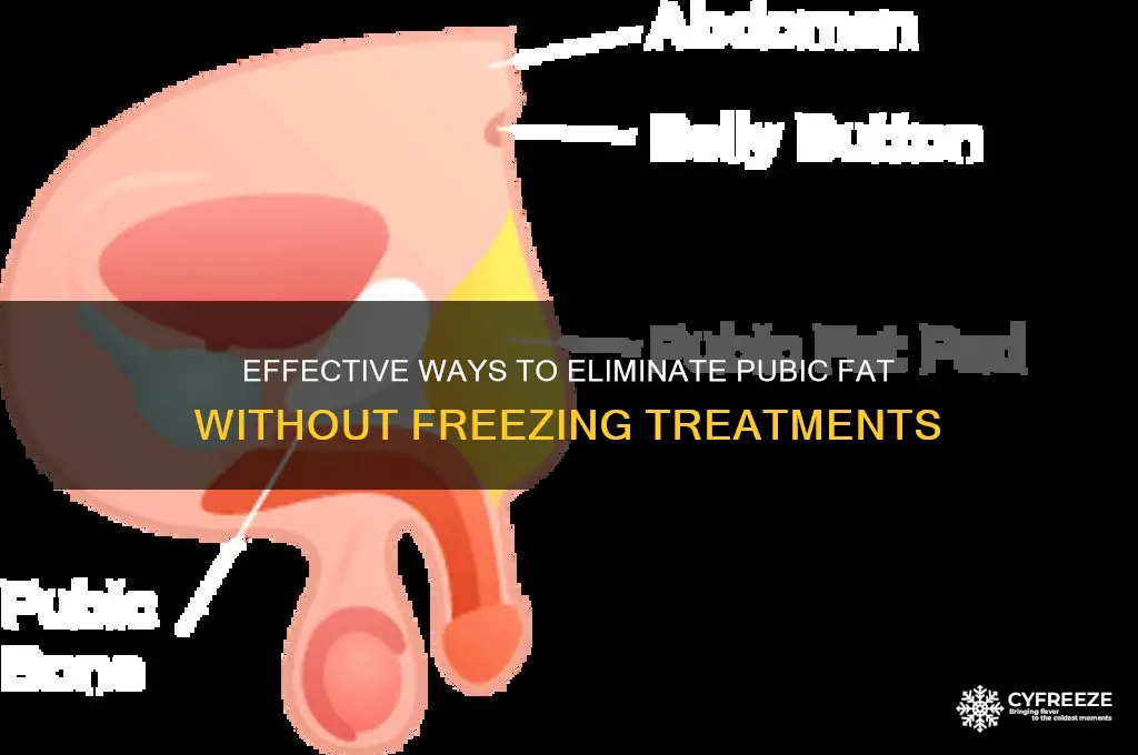 how to get rid of pubic fat freezing treatments