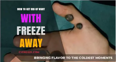Effective Wart Removal: Freeze Away Treatment Guide for Smooth Skin
