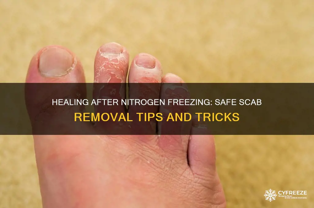 how to get scab off sfter nitrogn freez