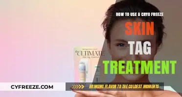 Effective Cryo Freeze Skin Tag Removal: A Step-by-Step Guide