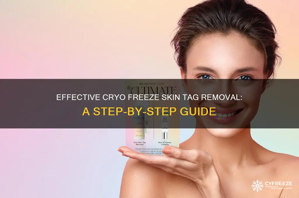 how to use a cryo freeze skin tag treatment