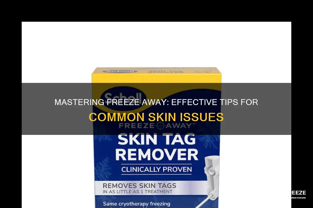 how to use freeze away common &amp