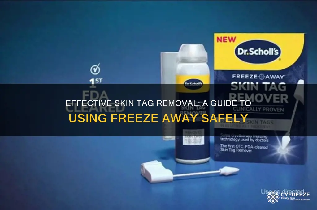 how to use freeze away on skin tags